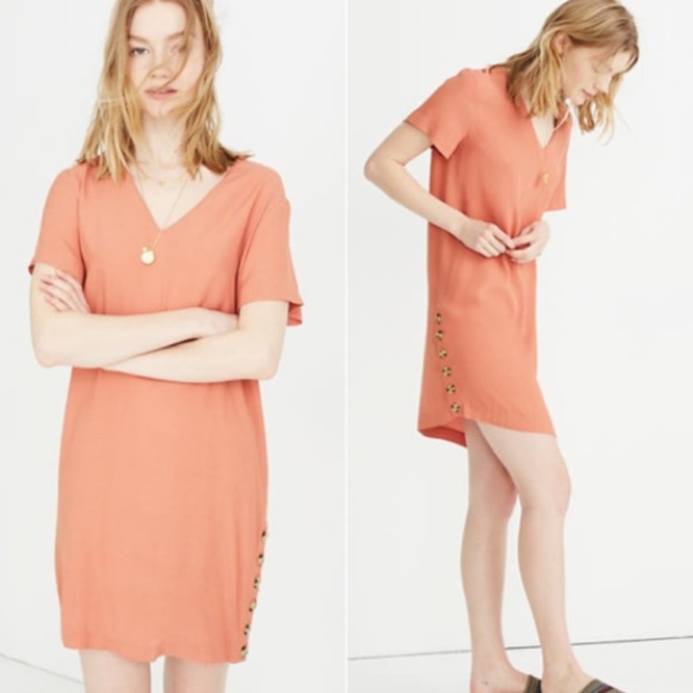 Madewell Side-Button Easy Dress